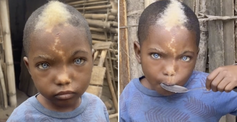 Little boy with natural blue eyes, white hairs and lightning mark down his face goes viral