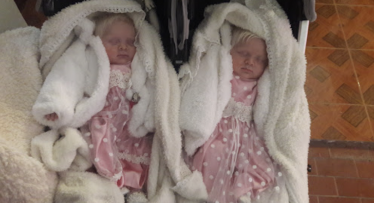 Mom delivers twin girls with matching snow-white hair, and their unusual beauty comes out years later