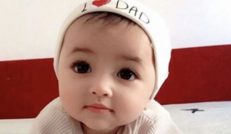 A baby with stunning eyes was born five years ago. How she looks now