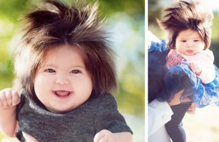 “Born with thick hair” | what does a girl who was born with hair look like today