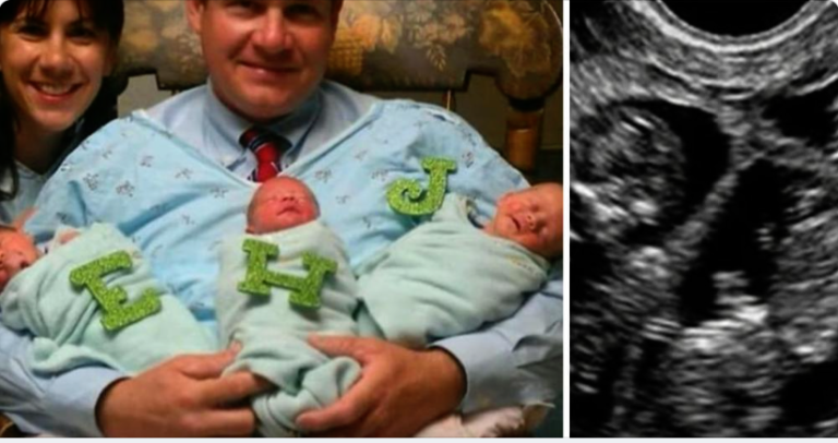 After Adopting Triplets, Couple Gets A Surprising  Call From The Doctor About Wife’s Sonogram