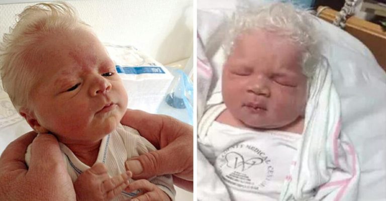 Baby born with full head of gray hair wins the hearts of all around him