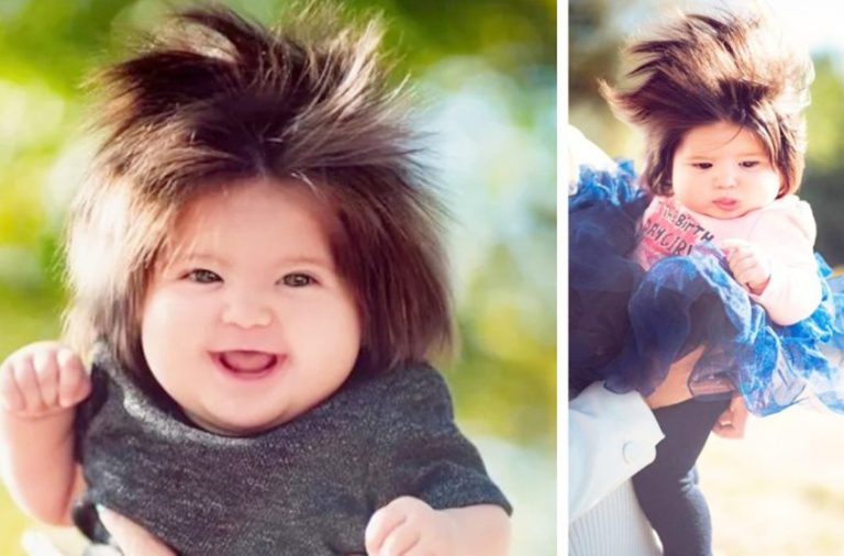 “Born with thick hair” | what does a girl who was born with hair look like today